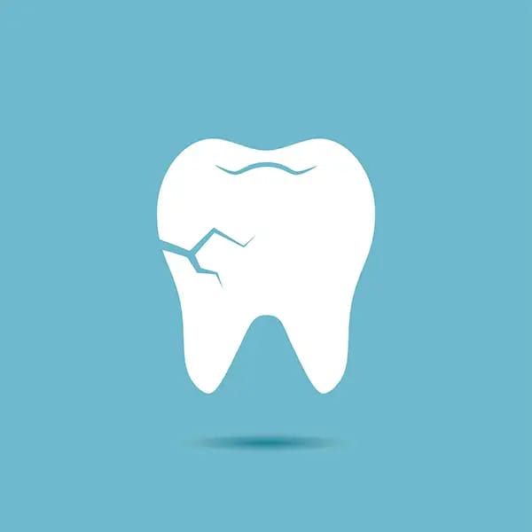 Cracked tooth damage from chewing ice cubes requiring dental repair