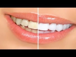 Taheri Dental healthy teeth