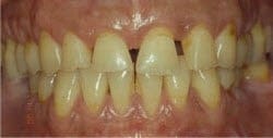 Patient 25634 Before Photo