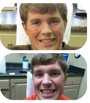 Before and after