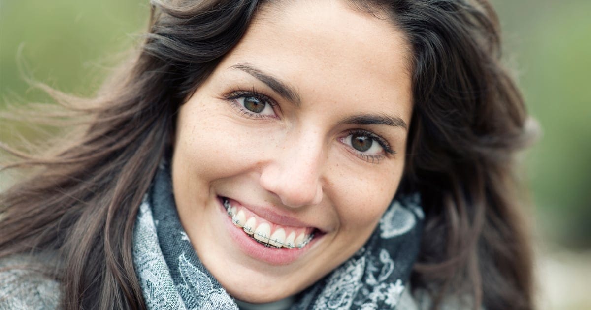Regenerate Your Smile with Discreet Adult Braces