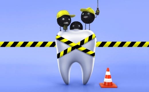 How Much Do You Know About Common Teeth Problems?