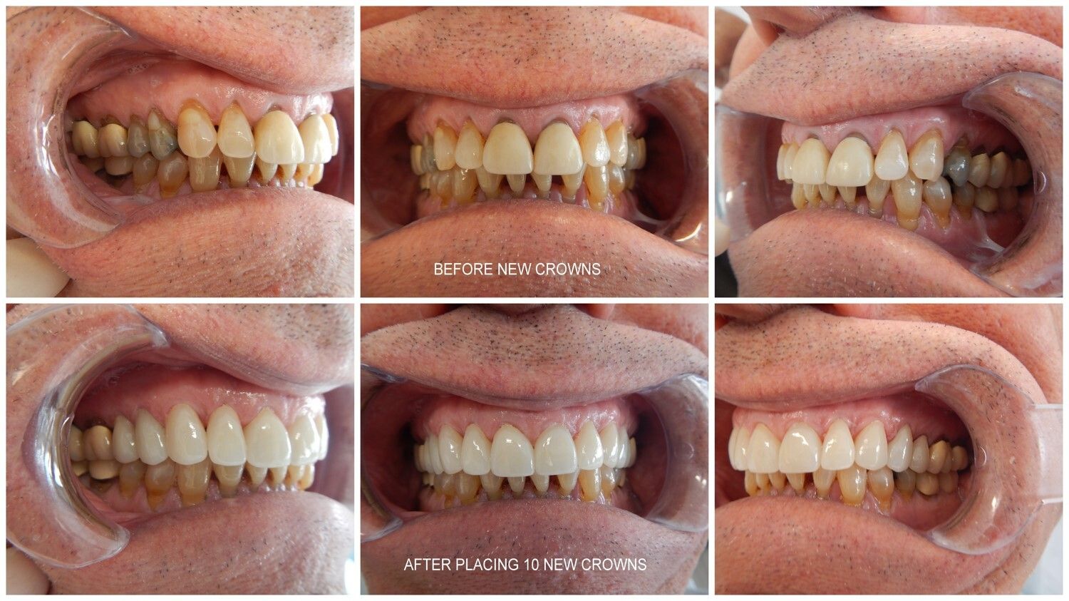 Smile Gallery - before and after 9