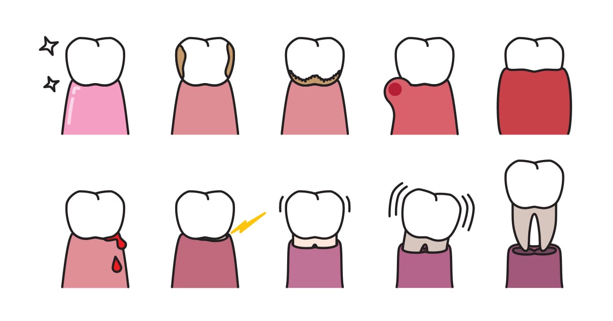Get the Basics: Periodontal Disease and Dental Care