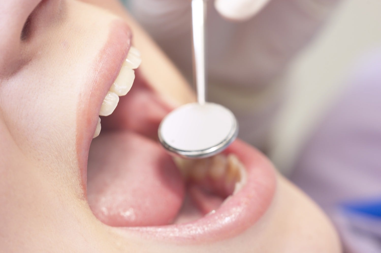Simple ways to help your kids overcome their fear of dentists Simple ways to help your kids overcome their fear of dentists