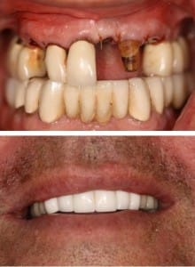Before & After Walding and Associates