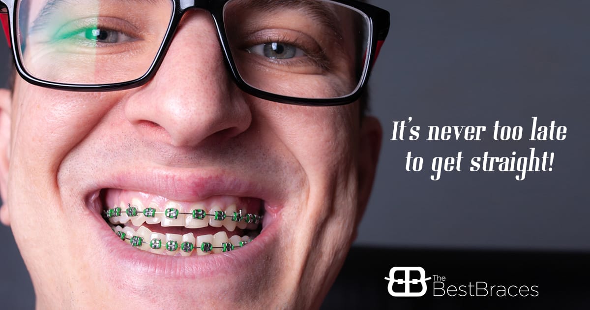 Did You Know That More Adults Are Getting Braces? Did You Know That More Adults Are Getting Braces?