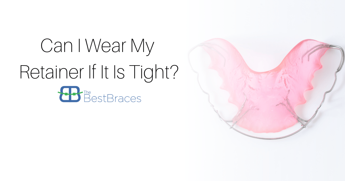 Can I Wear My Retainer If It Is Tight?