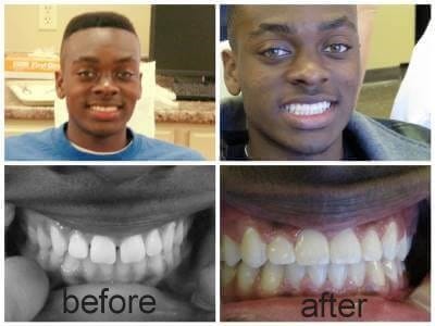Before and after