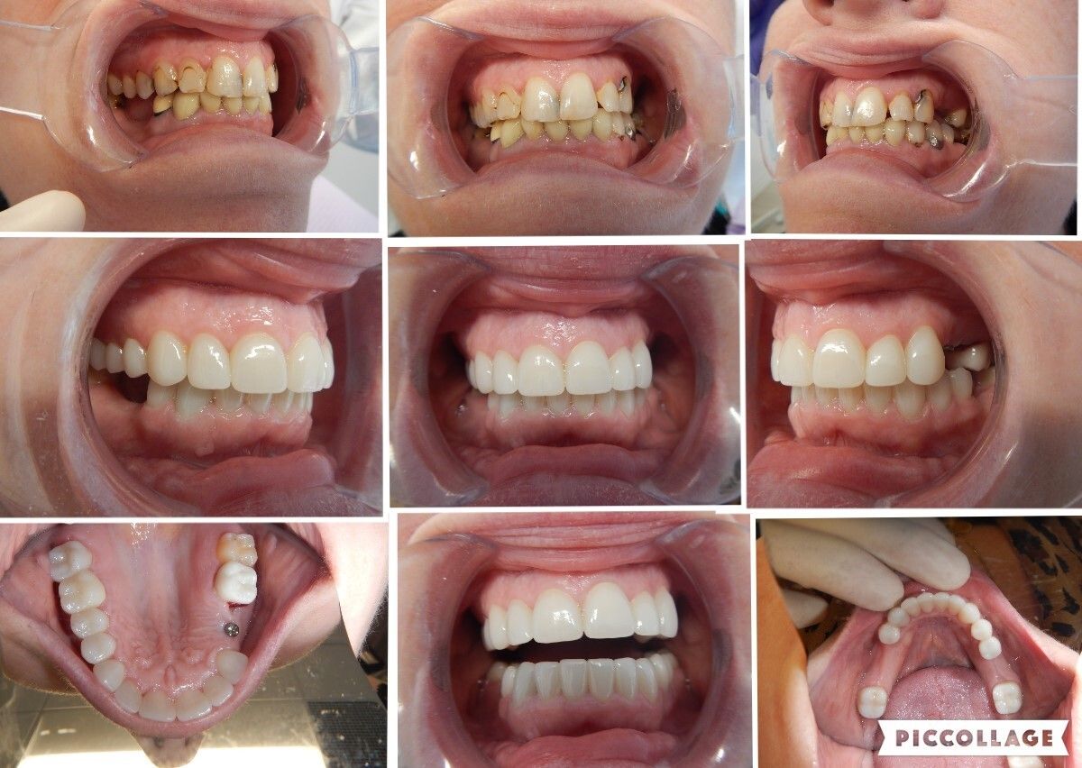 Before And After - picture 2
