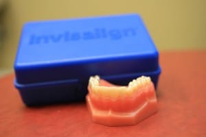 Invisalign