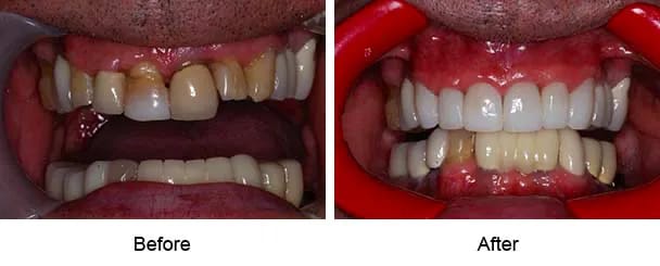 Smile Galley Before and After
