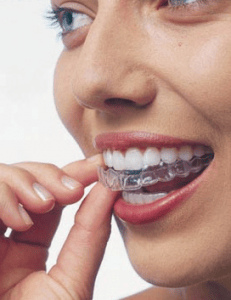 Woman using invisalign aligners