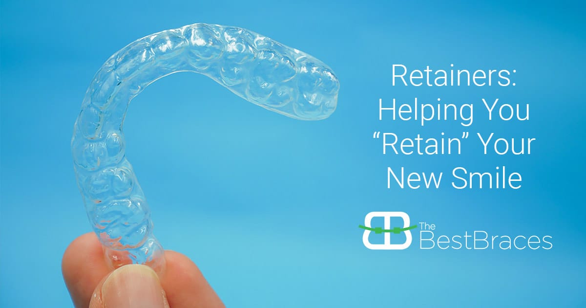 Retainers Help You Retain Your New Smile