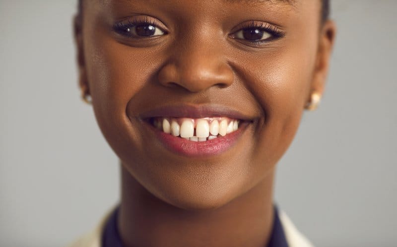 Get Rid of the Gaps- Can Dental Bonding Eliminate Space Between Teeth Get Rid of the Gaps- Can Dental Bonding Eliminate Space Between Teeth