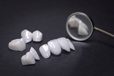Veneers bright smiles