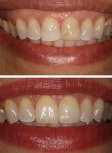 Before & After Walding and Associates