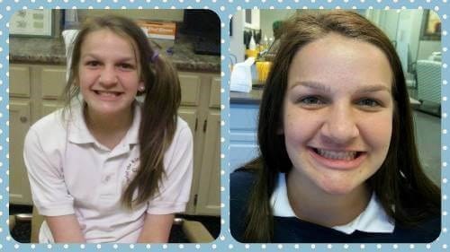 Before and after