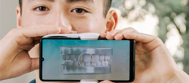 Dental Monitoring