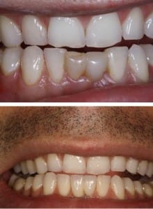 Before & After Walding and Associates