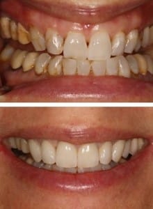 Before & After Walding and Associates