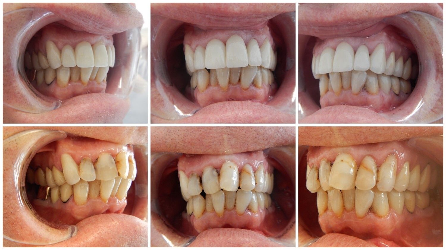 Smile Gallery - before and after 8