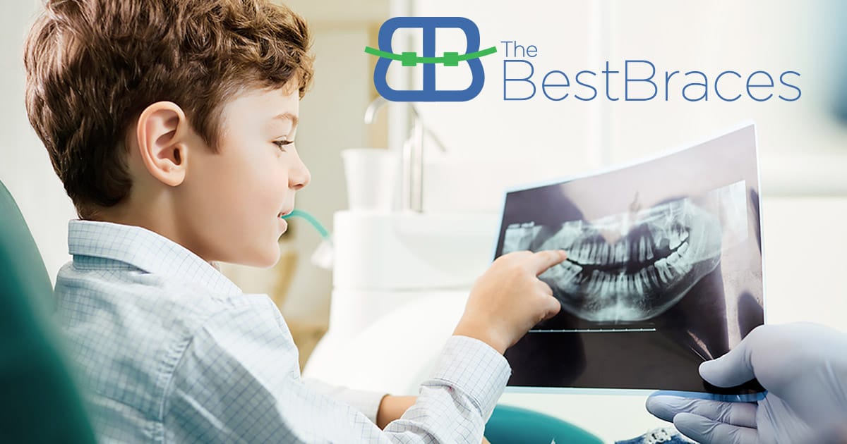 When to Bring Your Child to the Orthodontist