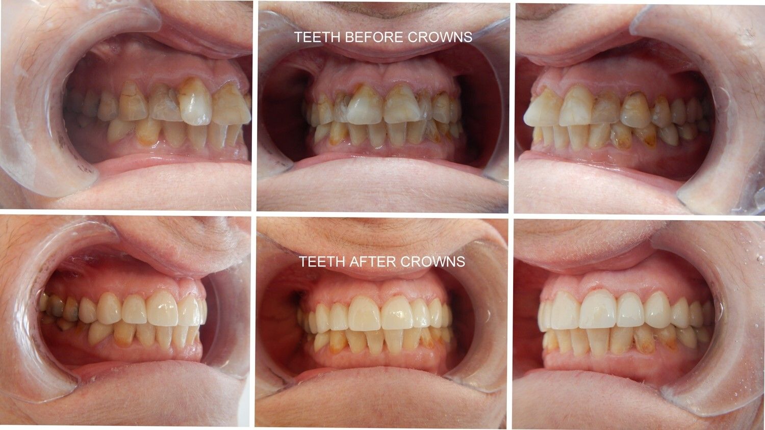 Smile Gallery - before and after 7