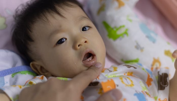 ACD laser dentistry and frenectomy service