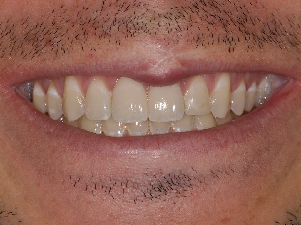 Virginia DC case 80 after