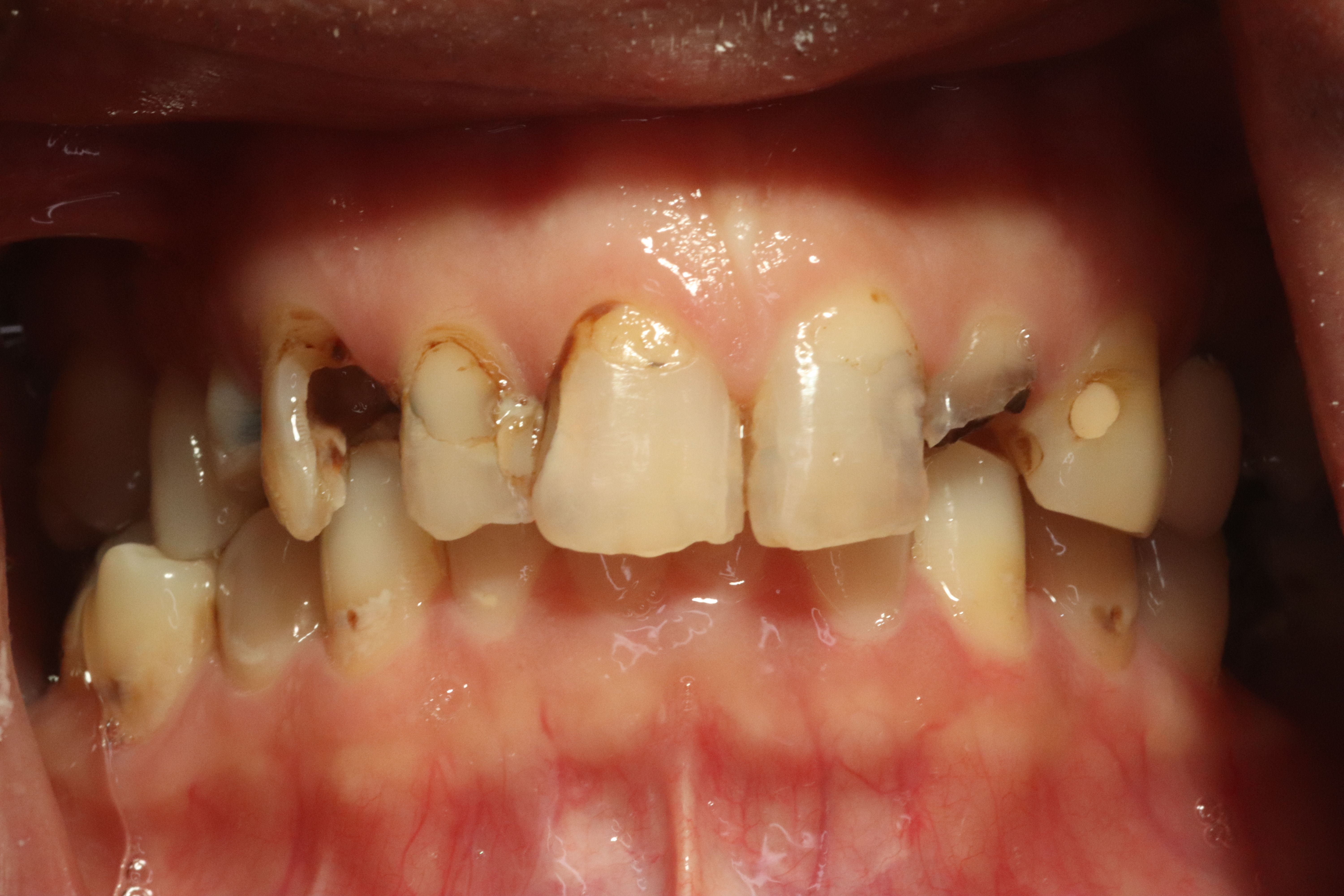 Rasner Smile gallery before 4