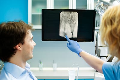 Digital X-Ray