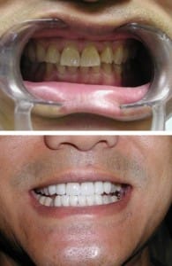 Before & After Walding and Associates
