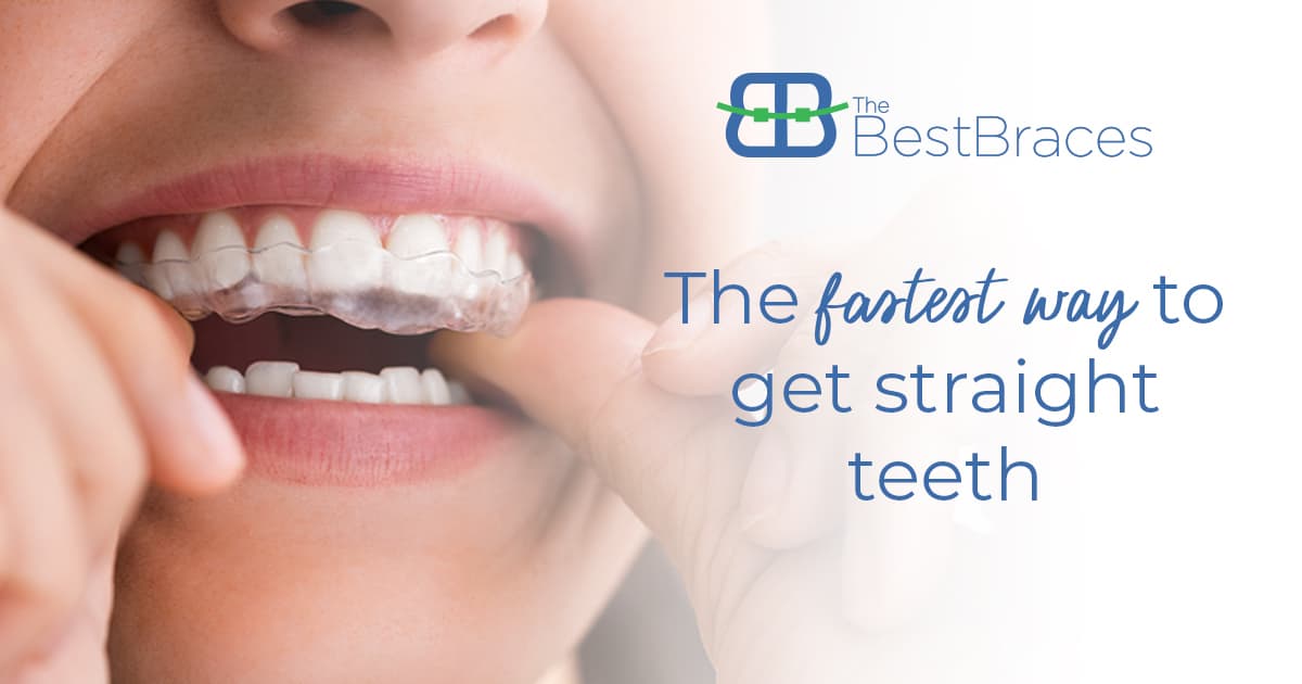 The Fastest Way To Get Straight Teeth The Fastest Way To Get Straight Teeth