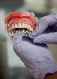 Invisalign
