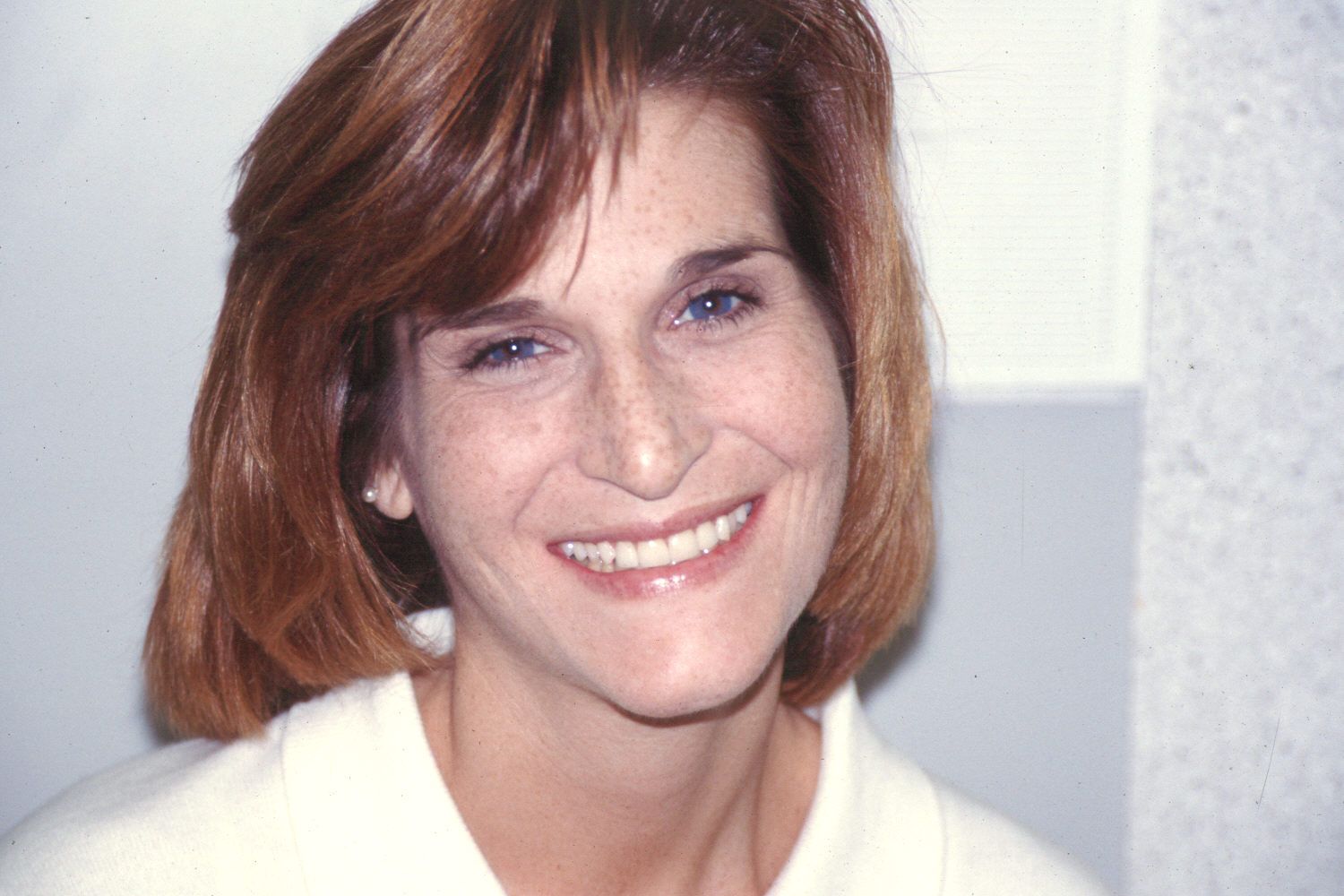 Rasner Smile gallery after 14