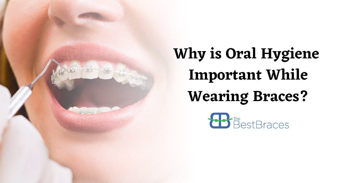 Why is Oral Hygiene Important While Wearing Braces? Why is Oral Hygiene Important While Wearing Braces?