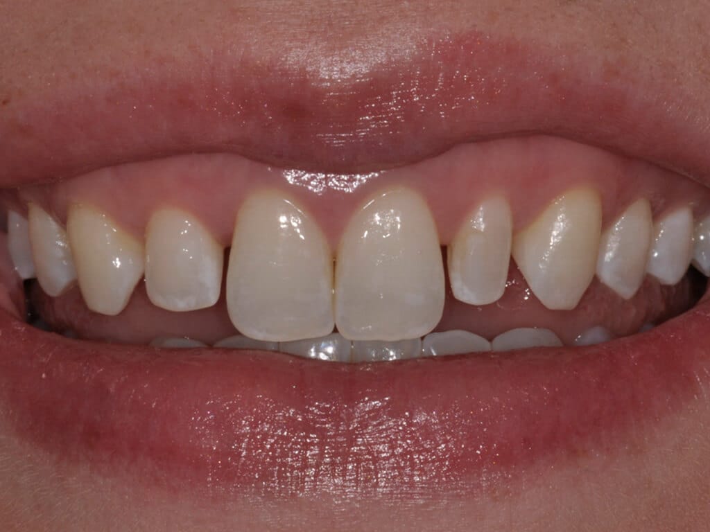 Virginia DC case 76 before