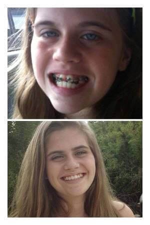 Before and after