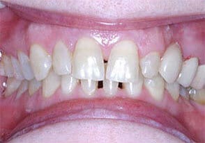 ballston smile gallery case-10-before