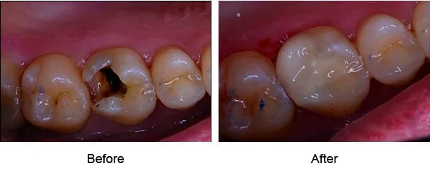 Smile Galley Before and After