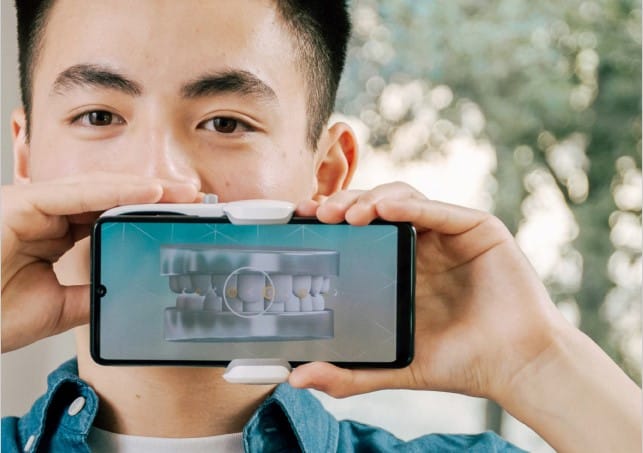 Man with DentalMonitoring technology for orthodontic treatment from Orthodontics by Birth and Fletcher