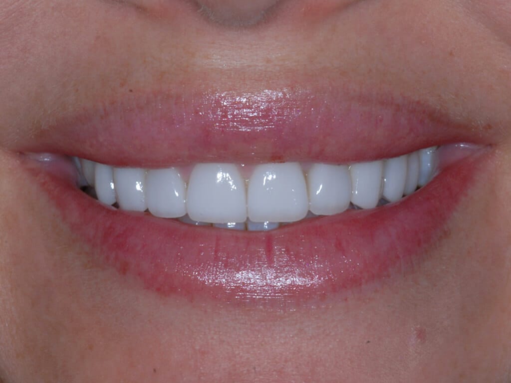 Virginia DC case 81 after