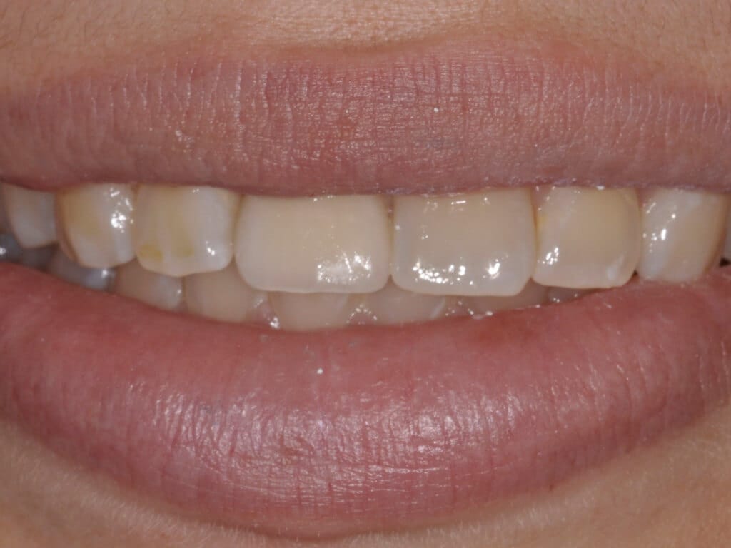 Virginia DC case 74 after