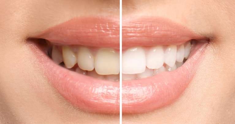 Woman Smiling Woman Smiling