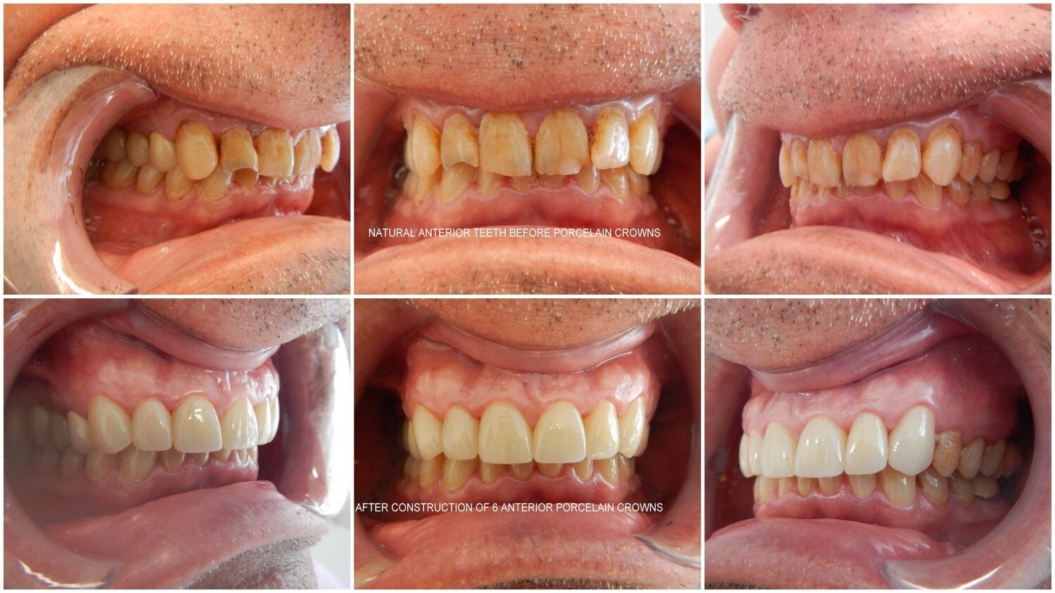 Smile Gallery - before and after 5