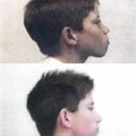 orthodontics orthodontics