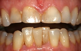 Smile Gallery - before