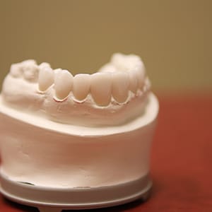 Teeth Mold