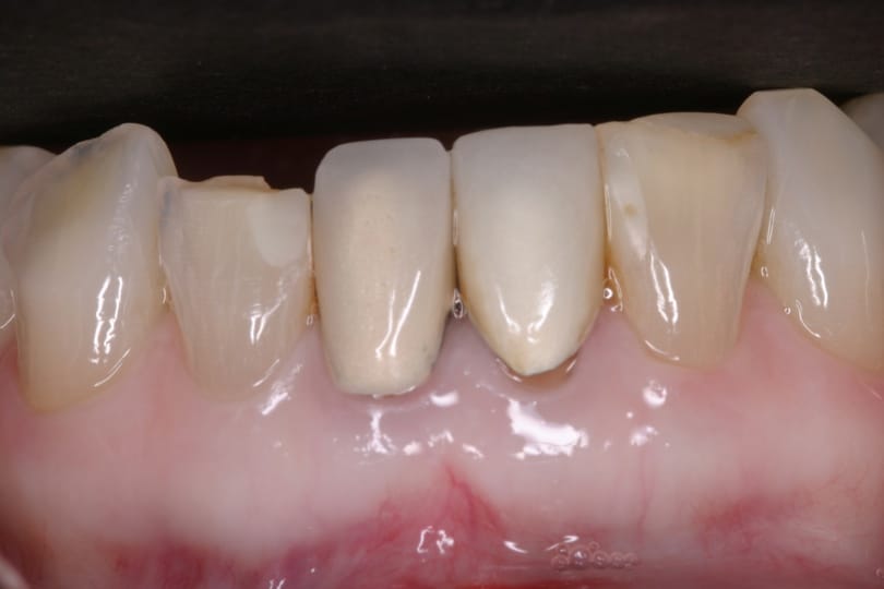 Rasner Smile gallery before 11